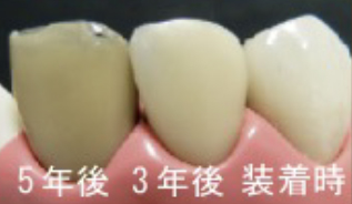 治療前