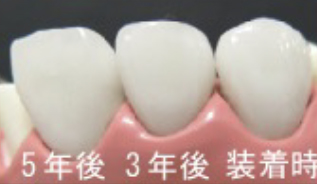 治療後