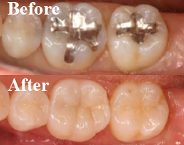 BEFORE・AFTER