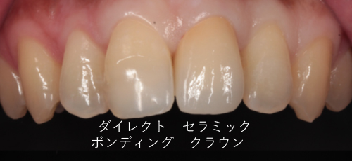 Case.1-2